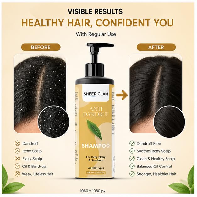 Sheer Glam Anti Dandruff Shampoo