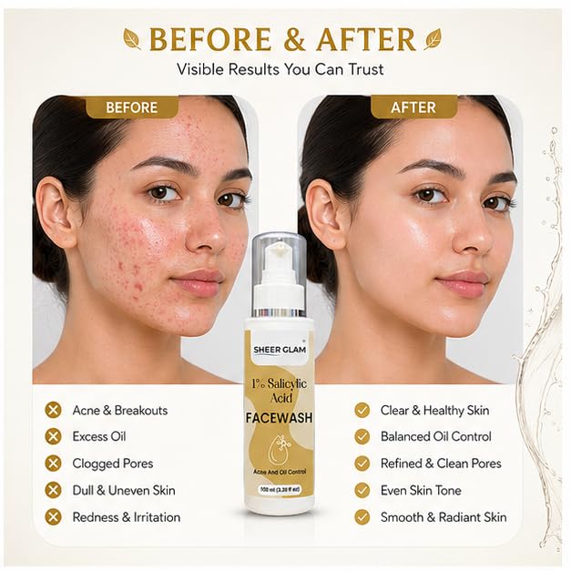 Sheer Glam 1% Salicylic Acid Face Wash 100 ml