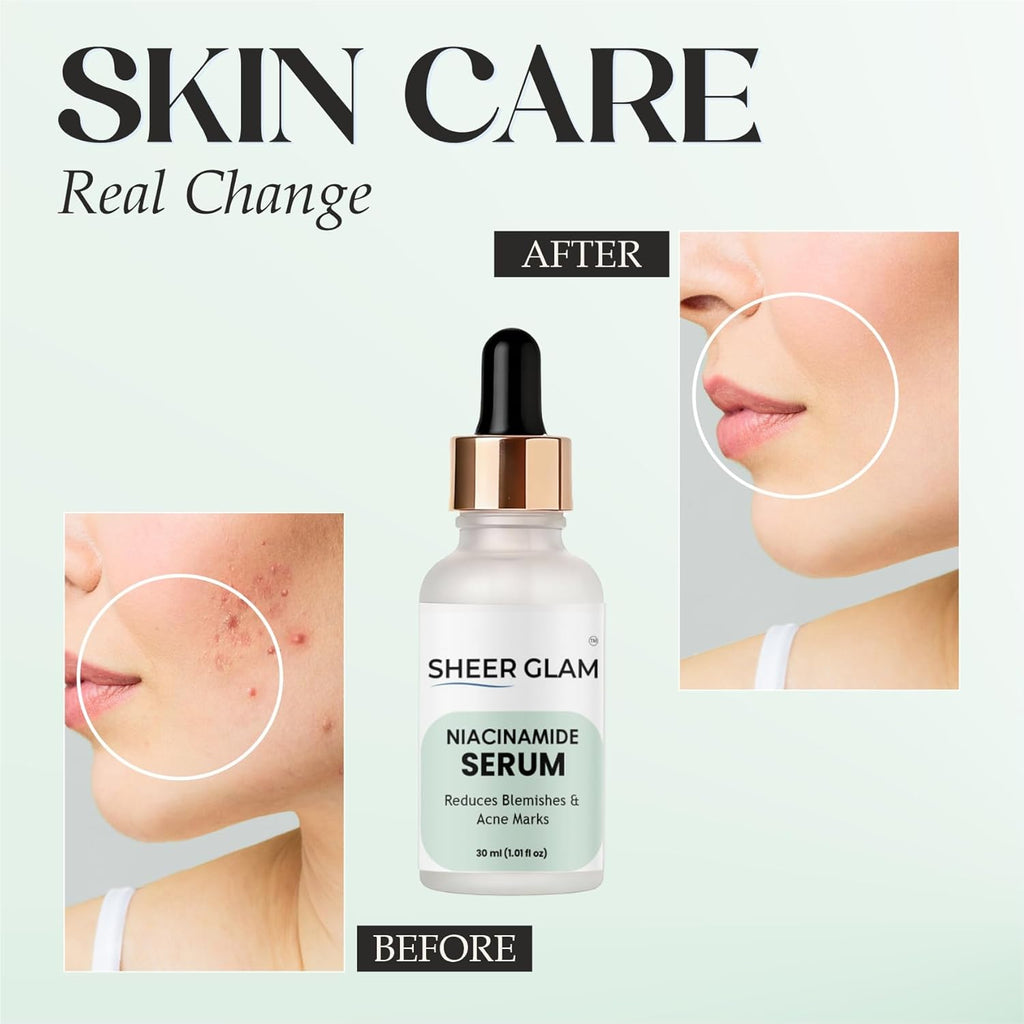 Sheer Glam Niacinamide Serum, 30 ml
