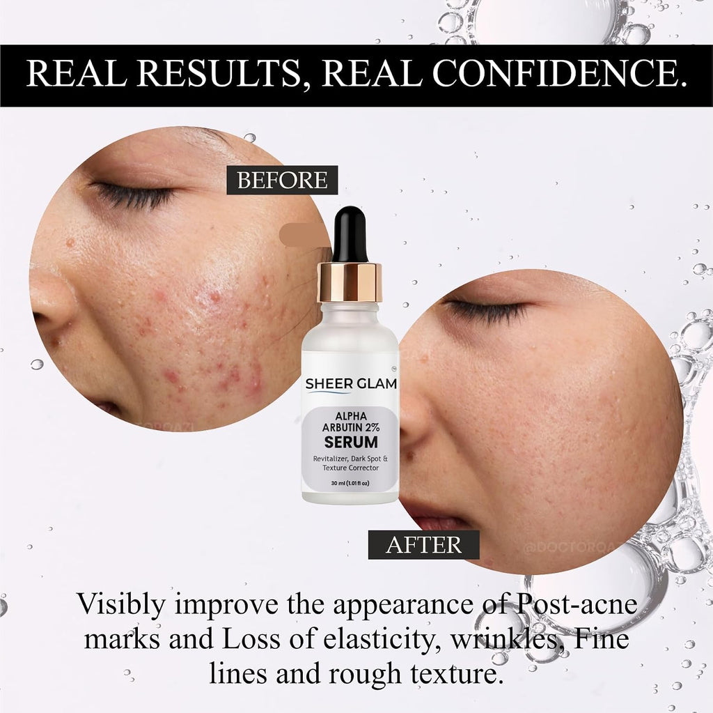 Sheer Glam Alpha Arbutin 2% Serum, 30 ml