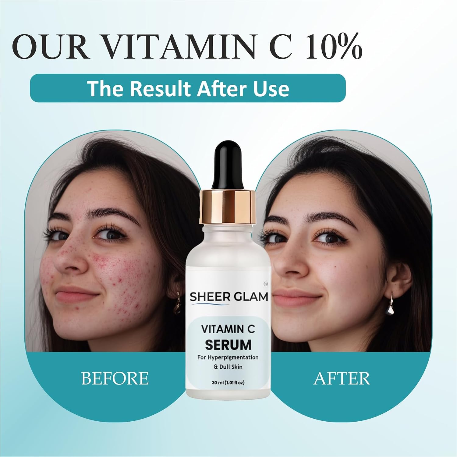 Sheer Glam Vitamin C Serum for Hyperpigmentation & Dull Skin, 30 ml